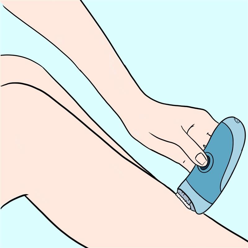 Epilation